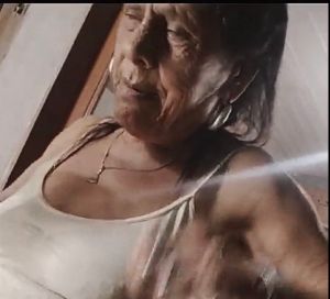 Ela precisa fazer uma cirurgia 