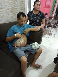 Ajuda para recuperação do irmão Anselmo 