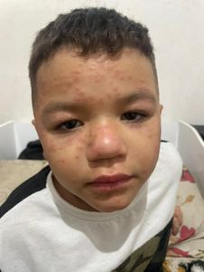 Ajude A Comprar O Medicamento Para O Caleb