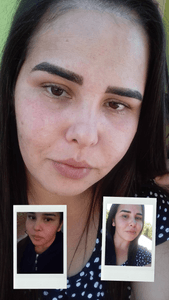 Cirurgia de emergência, câncer 