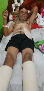 Preciso de ajuda para fazer uma cirurgia de Colostomia, estou aguardando essa cirurgia Des de 2014