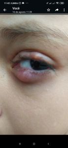 Cirurgia de criança 