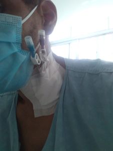 Ajuda para custear o tratamento de insuficiência renal crônica do UANDERSON