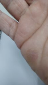 DEFICIENTE FÍSICO PRECISA DE AJUDA