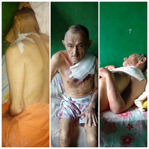 Ajudar manoel a vencer o câncer 