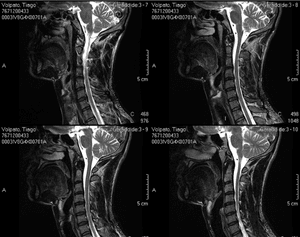 Ajuda para compra de cadeira ergonômica indicada pelos médicos devido problema na cervical