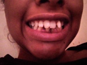 Tratamento dentário 