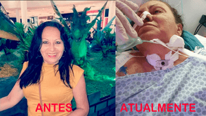 Marisa Alves Silva: Reacendendo a Luz após Encefalopatia Hipóxica e Lesões Graves