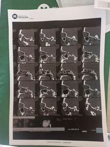 Recadar dinheiro para pagar a anestesia da minha cirurgia dos seios da face