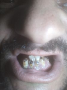 Sorriso e fazer outra pessoa sorrir 