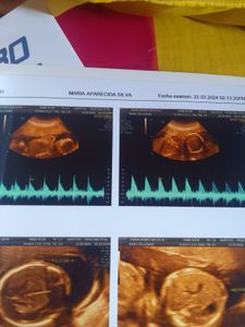 Preciso de ajuda para minhas gemiais vim ao mundo no tempo certo com saude .