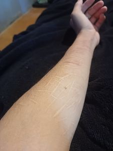 Tatoo para tirar cicatriz do braço