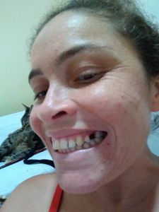 Sorriso mais brilhante 