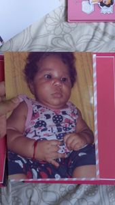 Precisa passar com o neuro pediatra 