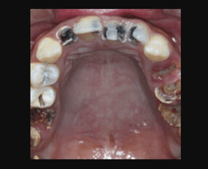 Preciso muito de ajuda para voltar a viver 