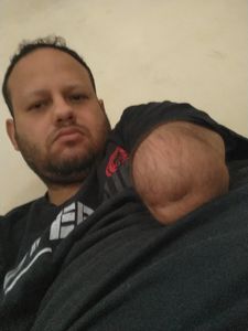 Deficiente físico, deprimido e endividado