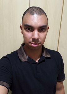 Nasci Com Hipoplasia Grande Nos Dentes