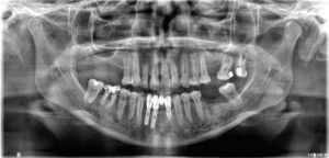 Vamos ajudar a ARLENE a fazer o tratamento dos dentes