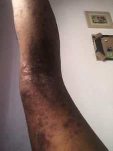 Todos pela Ana Julia 