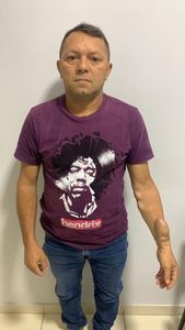 Tratamento para transplante de rins do Chico