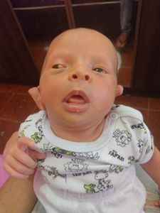 Meu filho nasceu com uma carninha no olho e precisa fazer cirurgia para retirar se não ele poderá até perde a visão gostaria de pedir a compreensão e a ajuda de vocês 