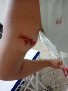 Cirurgia de emergência 