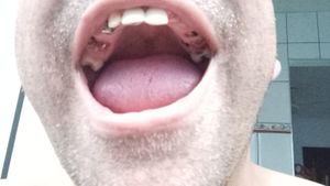 Ajude o george a arrumar o dentes