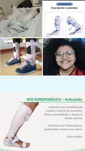 Ajuda para comprar as órteses da Cecília 💙