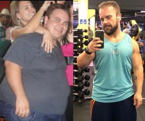 Retirada de pele após emagrecimento 