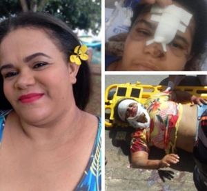 Sofrir um acidente e estou internada com fêmur quebrado 