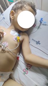 Tratamento para o Matheus.