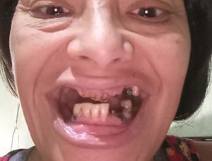 Aguda Para Tratamento Dentário 