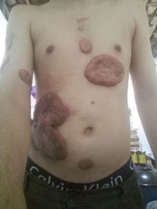 Em prol de Erasmo Franklin