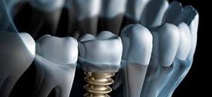 sorrir para trabalhar