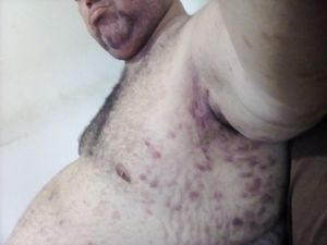 Tratamento de saúde