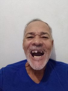 Próteses dentária 