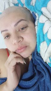 Tratamento com Lutécio-177 Radioativo.