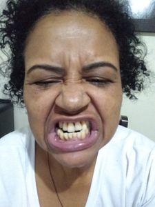 Devolvendo um sorriso saudável 