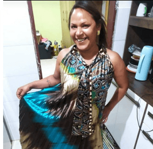 Vamos deixar o sorriso da Simone mais bonito!