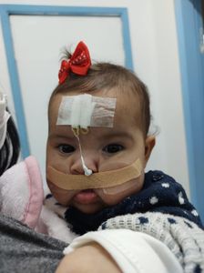 Arrecadação de Fundo para as Cirurgias da Laura Gomes - Fenda Palatina, Correção, estética, etc.