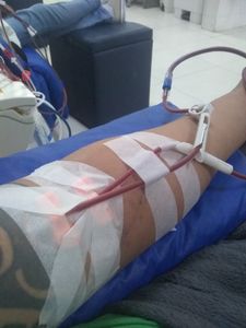 AJUDA PARA TRATAMENTO RENAL