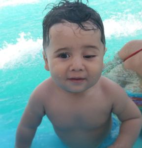 Cirurgia por risco de perder a visão, cirurgia plástica ocular - ptose palpebral congênita