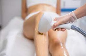 O que é Depilação a Laser?