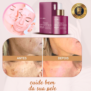 Óleo de rosa mosqueta faz mesmo bem para pele? é golpe? reclame aqui saiba tudo sobre óleo de rosa mosqueta 