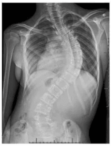 Ajuda ao meu filho que vai operar