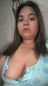 Reparadoras pos bariatrica