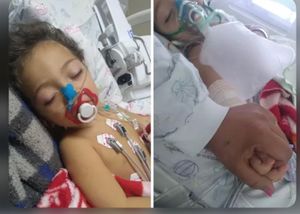 Ajude o Gabriel com tumor na cabeça 