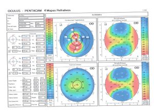 Vaquinha Online - Não Deixe o Lucas Perder a Visão