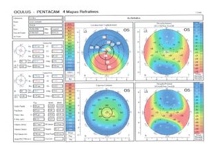 null - Não Deixe o Lucas Perder a Visão