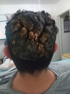 Saúde e Emergências - Ajuda para o Alex 